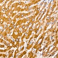 KO-Validated PCCB Rabbit mAb (20 μl)