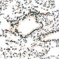KD-Validated PTBP1 Rabbit mAb (20 μl)