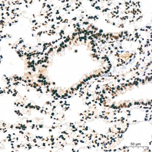 KD-Validated PTBP1 Rabbit mAb (20 μl)