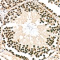 KD-Validated HNRNPA2B1 Rabbit pAb (20 μl)