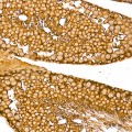 KD-Validated Argonaute-2 Rabbit mAb (20 μl)