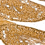 KD-Validated Argonaute-2 Rabbit mAb (20 μl)