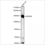 KD-Validated KDM2B Rabbit pAb (20 μl)