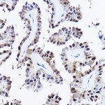 KO-Validated PDCD4 Rabbit pAb (20 μl)