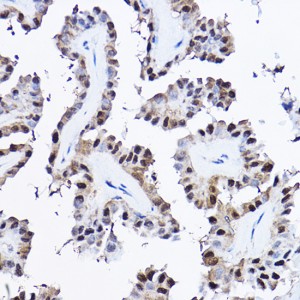 KO-Validated PDCD4 Rabbit pAb (20 μl)
