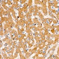KD-Validated CYB5R3 Rabbit mAb (20 μl)