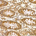 KD-Validated TRIM25 Rabbit mAb (20 μl)