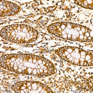 KD-Validated TRIM25 Rabbit mAb (20 μl)