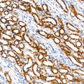 KD-Validated UQCRC1 Rabbit mAb (20 μl)