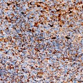 KO-Validated LAMP2 Rabbit PolymAb® (20 μl)