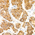 KD-Validated LYPLA1 Rabbit mAb (20 μl)
