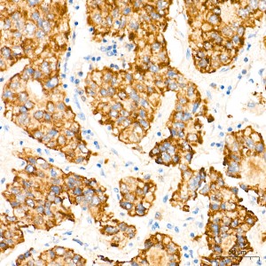 KD-Validated LYPLA1 Rabbit mAb (20 μl)