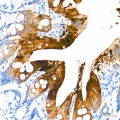 KD-Validated Peroxiredoxin 6 Rabbit mAb (20 μl)