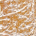 KD-Validated DYNC1H1 Rabbit mAb (20 μl)