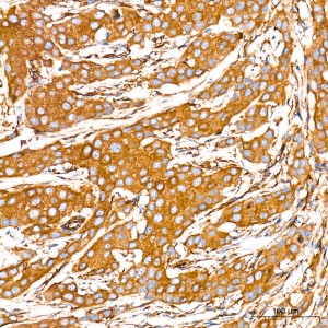 KD-Validated DYNC1H1 Rabbit mAb (20 μl)