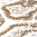 KD-Validated ADAR1 Rabbit mAb (20 μl)