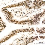 KD-Validated ADAR1 Rabbit mAb (20 μl)