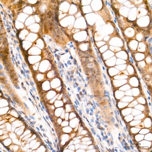 KO-Validated HIF1AN/FIH-1 Rabbit mAb (20 μl)