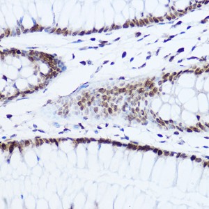 KO-Validated Histone H1.0 Rabbit pAb (20 μl)