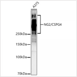 KO-Validated NG2/CSPG4 Rabbit pAb (20 μl)