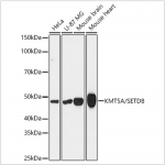 KD-Validated KMT5A/SETD8 Rabbit mAb (20 μl)