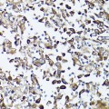 KO-Validated GARS Rabbit pAb (20 μl)