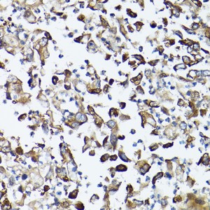 KO-Validated GARS Rabbit pAb (20 μl)