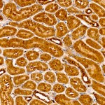 KO-Validated HIF1AN/FIH1 Rabbit pAb (20 μl)