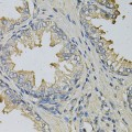 KO-Validated LITAF Rabbit pAb (20 μl)