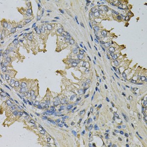 KO-Validated LITAF Rabbit pAb (20 μl)