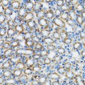 KO-Validated α-Catenin Rabbit pAb (20 μl)