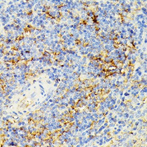 KO-Validated ECE1 Rabbit pAb (20 μl)