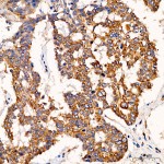 KO-Validated SND1 Rabbit pAb (20 μl)