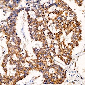 KO-Validated SND1 Rabbit pAb (20 μl)