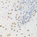 KO-Validated HuR/ELAVL1 Rabbit pAb (20 μl)