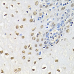 KO-Validated HuR/ELAVL1 Rabbit pAb (20 μl)