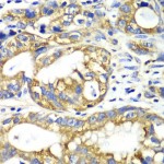 KO-Validated AK2 Rabbit pAb (20 μl)