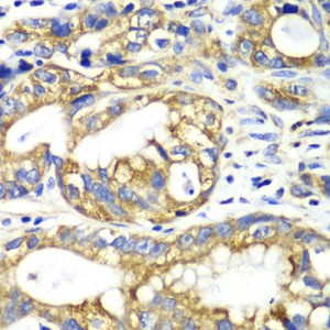 KO-Validated AK2 Rabbit pAb (20 μl)