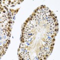 KO-Validated CIRBP Rabbit pAb (20 μl)