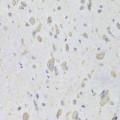 KO-Validated EEF1B2 Rabbit pAb (20 μl)