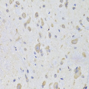 KO-Validated EEF1B2 Rabbit pAb (20 μl)