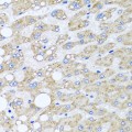 KO-Validated SRI Rabbit pAb (20 μl)