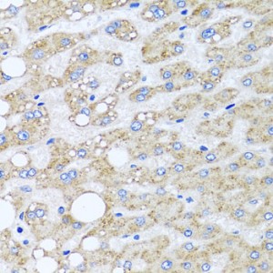 KO-Validated SRI Rabbit pAb (20 μl)