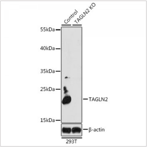 KO-Validated TAGLN2 Rabbit pAb (20 μl)