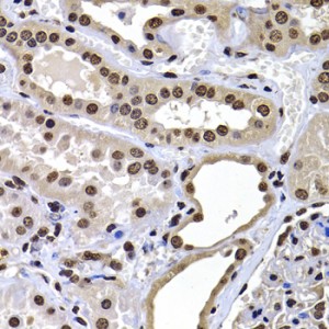 KO-Validated macroH2A.1 Rabbit pAb (20 μl)