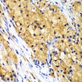 KO-Validated CAPG Rabbit pAb (20 μl)