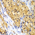 KO-Validated CAPG Rabbit pAb (20 μl)