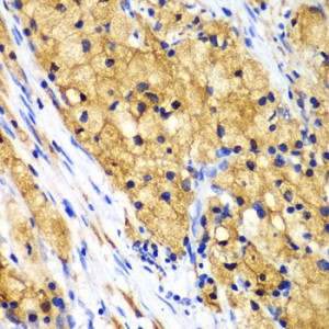 KO-Validated CAPG Rabbit pAb (20 μl)