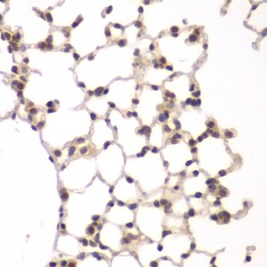 KO-Validated VRK1 Rabbit pAb (20 μl)