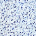 KO-Validated SAMHD1 Rabbit pAb (20 μl)
